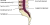 Een schematische weergave van de ruggewervel/hernia