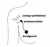 De eerste lymfeklier waar dit vocht langskomt, noemen we de schildwachtklier