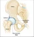Impingement van de heup