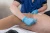 Therapeutische elektrische koud spataderbehandeling